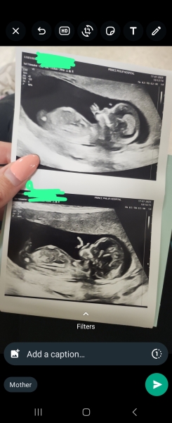 Boy or girl 