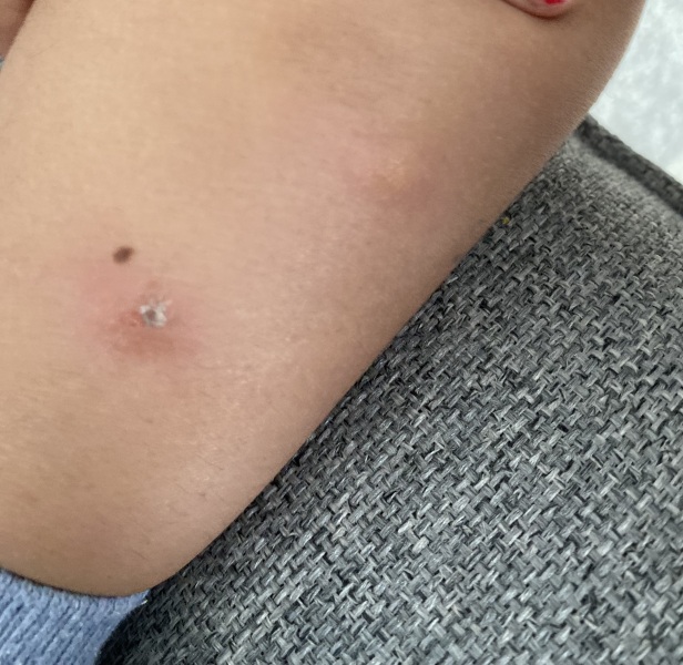 Bed Bug? (With pics)
