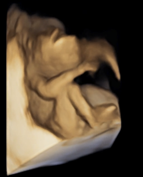 Does this show gender?