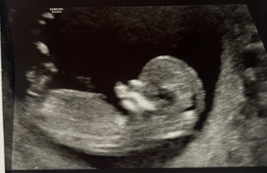 Due January Part 4! 🎉