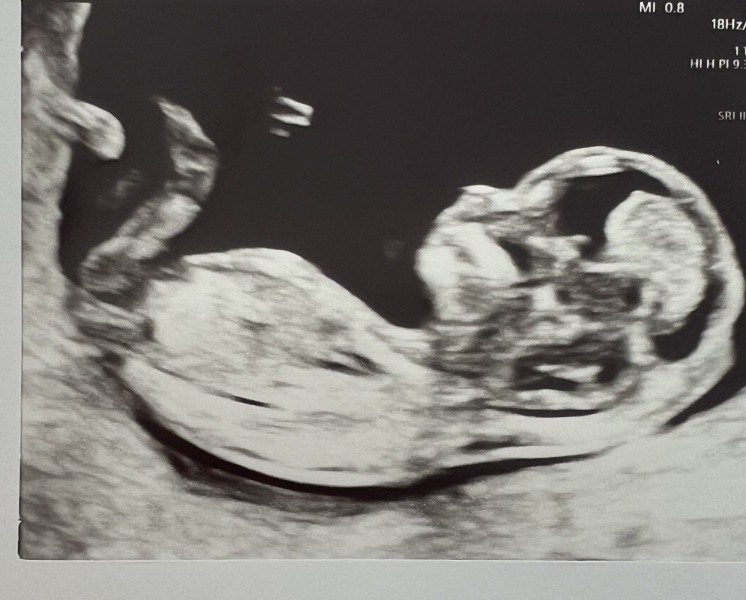 Boy or girl predictions please!