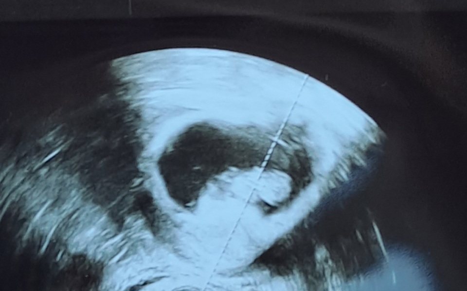 February 2024 babies 🤰 (Thread 2)