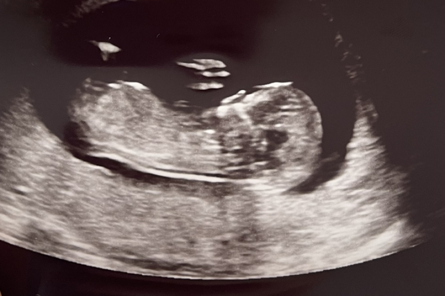 Due January 2024 🎉 PART 3