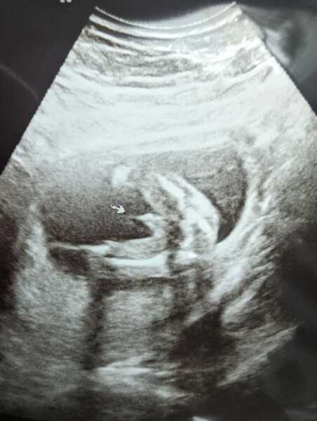 Due January Part 5 🎉