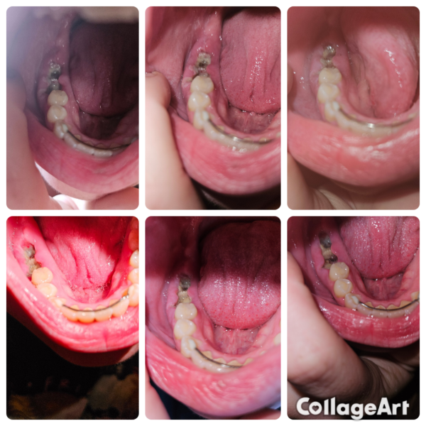 Any dentists around? Photo TMI !