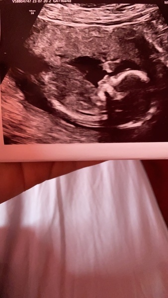 Boy or girl???