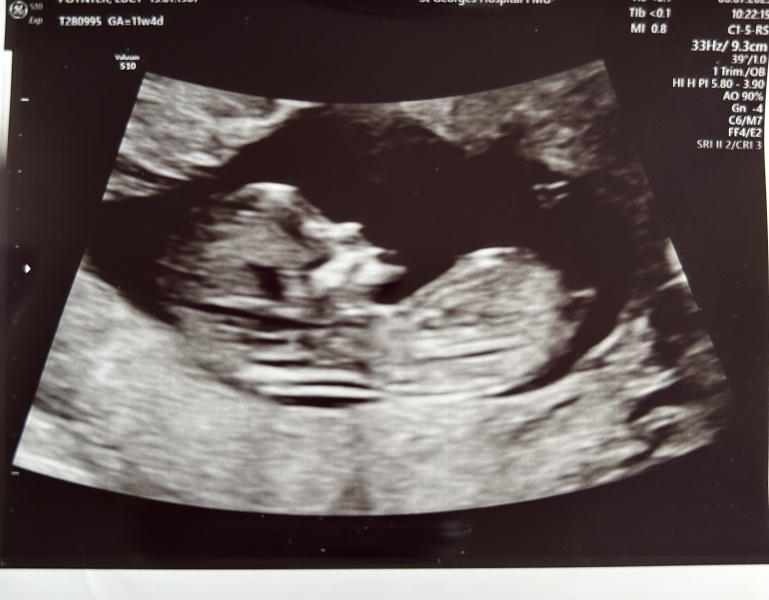 Due January Part 4! 🎉