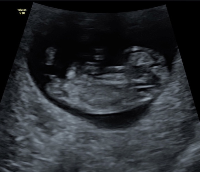 February 2024 Babies 👶 (thread 3)