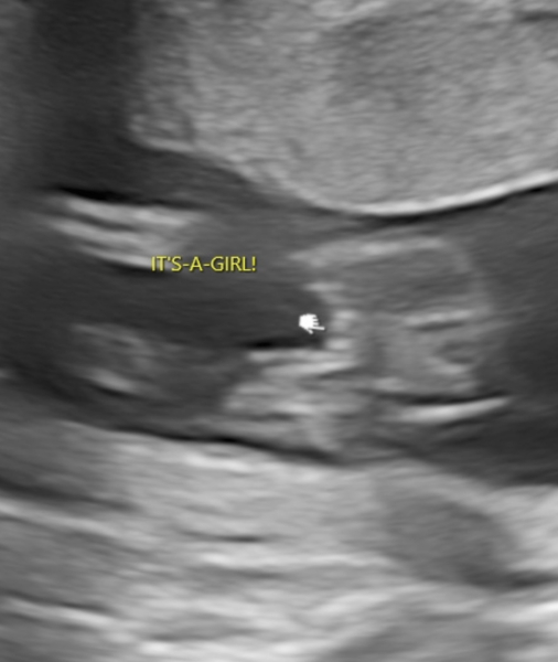Due January Part 5 🎉