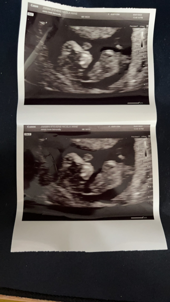 Pregnant after miscarriage - support thread NEW