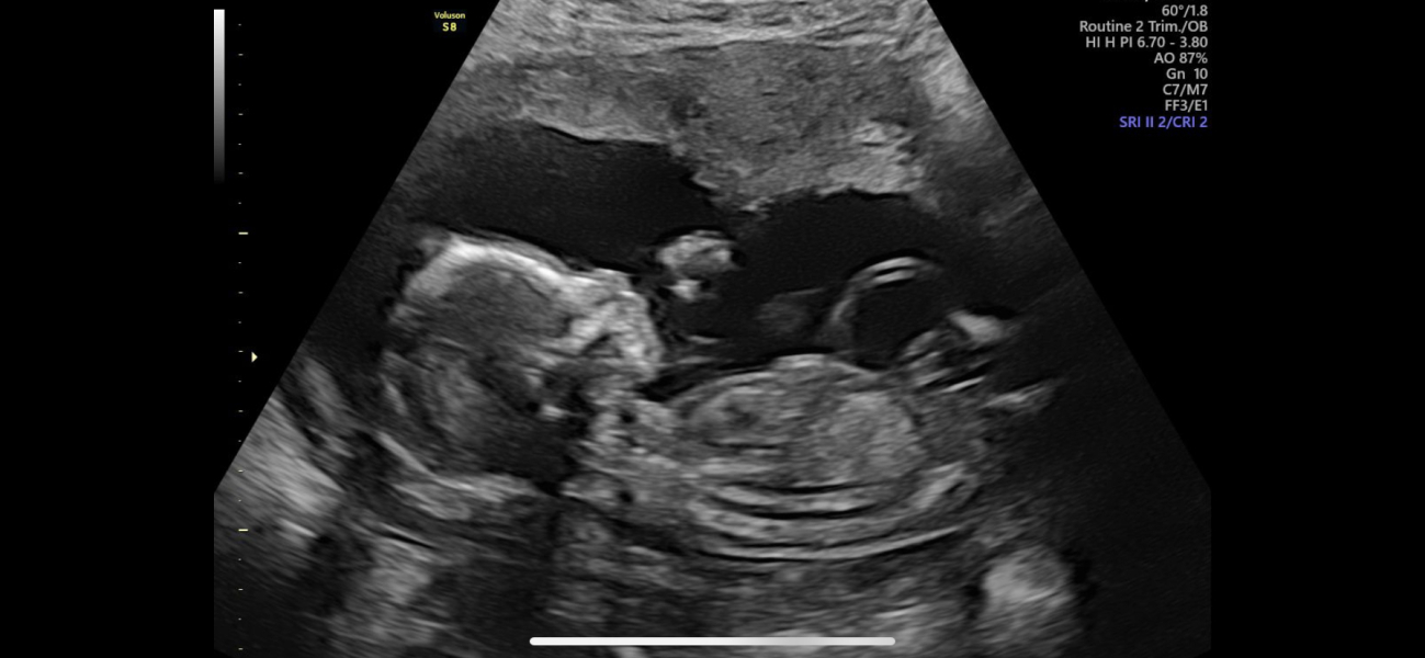 Due January Part 5 🎉