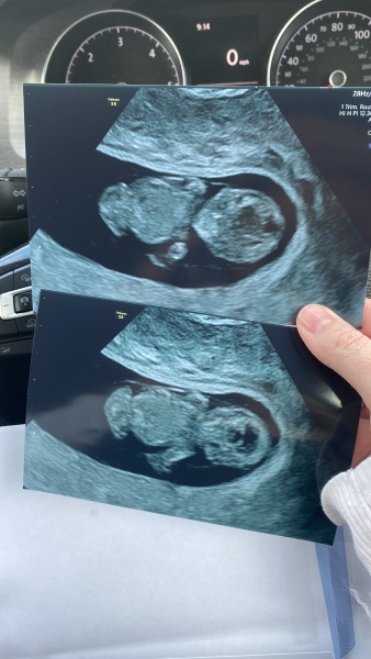 February 2024 babies 🤰 (Thread 2)