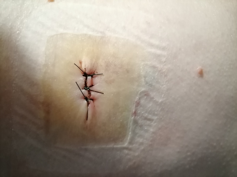 Do my stitches look ok? (pics included) 