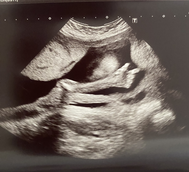 Due December 2023 part 4 