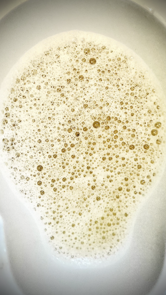 Re protein in urine