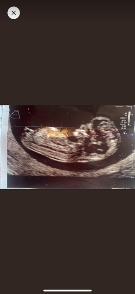 Boy or Girl? 