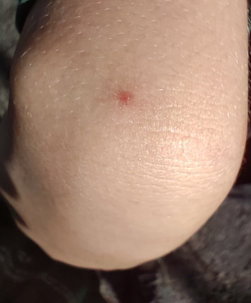 What is this spot?