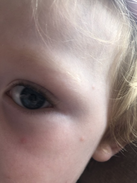 Any idea?! 8 mo rash/spots