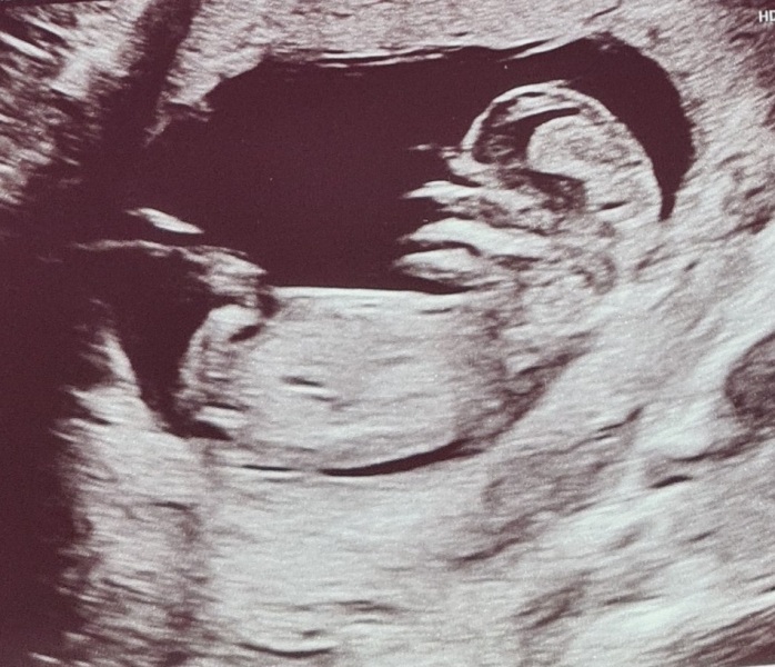 Due January Part 4! 🎉