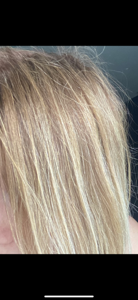 Really brassy bleacher hair ,can you help ?(pic included )