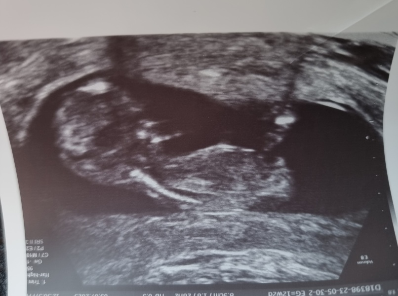 Due January 2024 🎉 PART 3