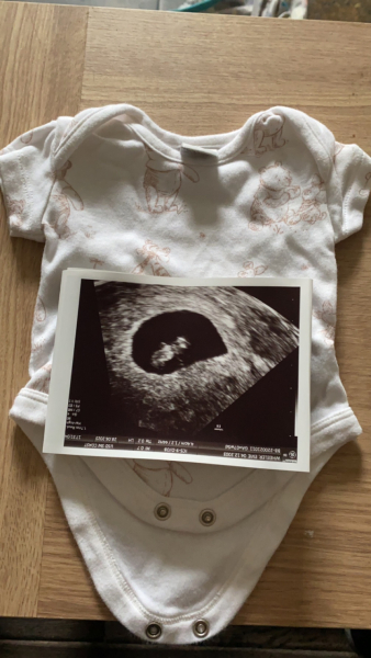 To book an early scan or wait it out?