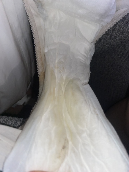 Discharge or waters leaking? Warning photo TMI