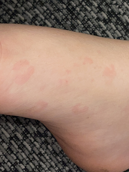 Can anyone tell me what this is on my son please?