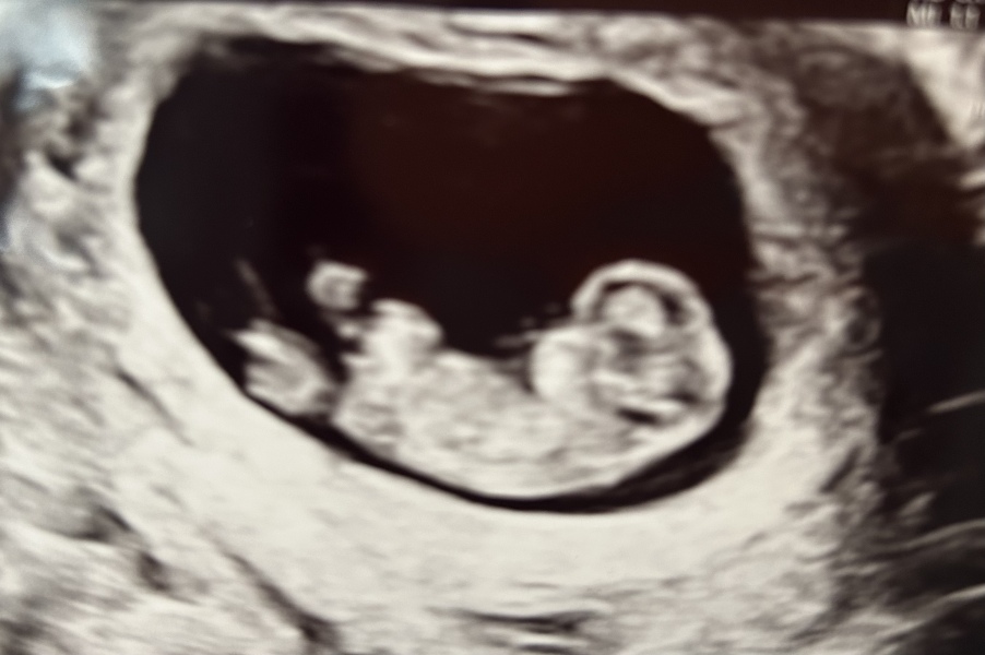 February 2024 Babies 👶 (thread 3)