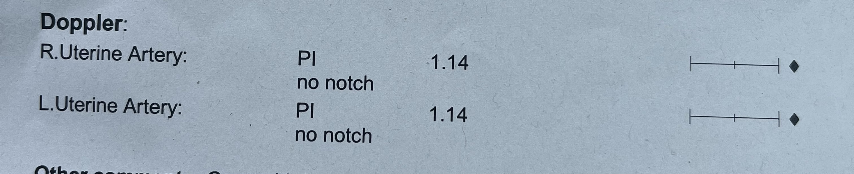 Uterine artery pi notch? 
