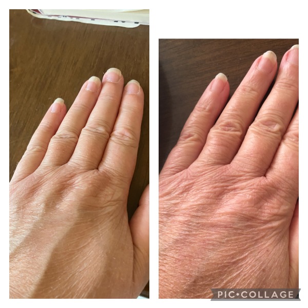 Can you see any improvement (pics) 