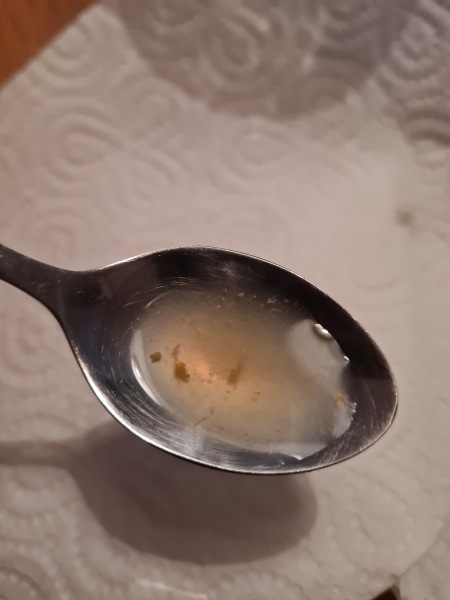 What are these yellow bits in my colostrum?