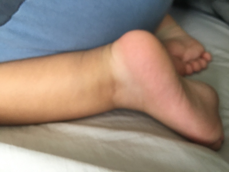 Is this vitiligo ?