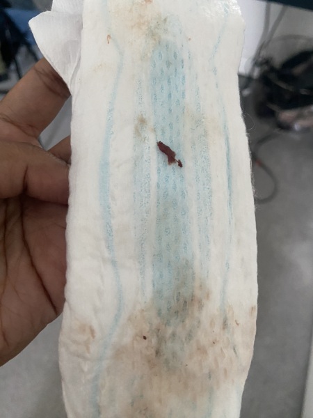 Implantation bleeding