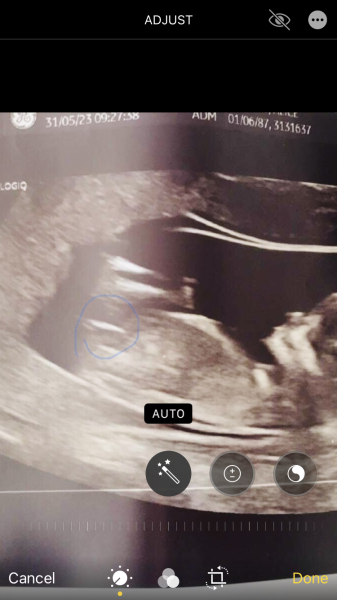 Pls would you guess our gender!!! Too excited to contain myself!!