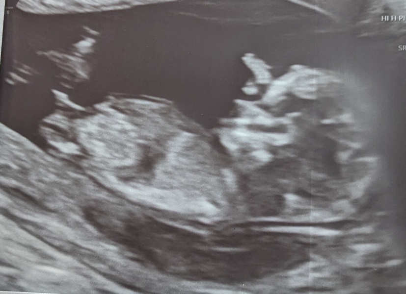 Due January Part 4! 🎉