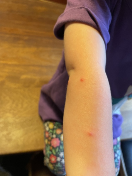 To wonder what these bites are?