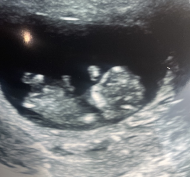 Due January Part 4! 🎉