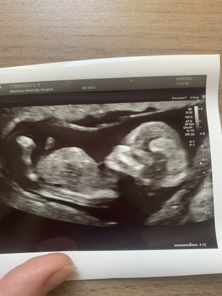 Due January Part 4! 🎉