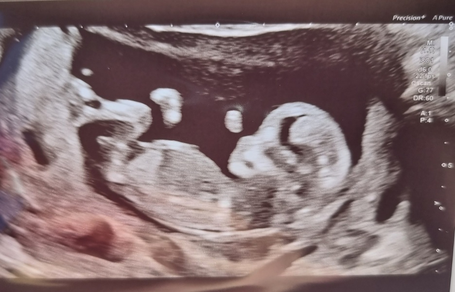 Due January Part 4! 🎉