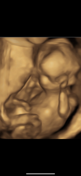 Due January Part 4! 🎉