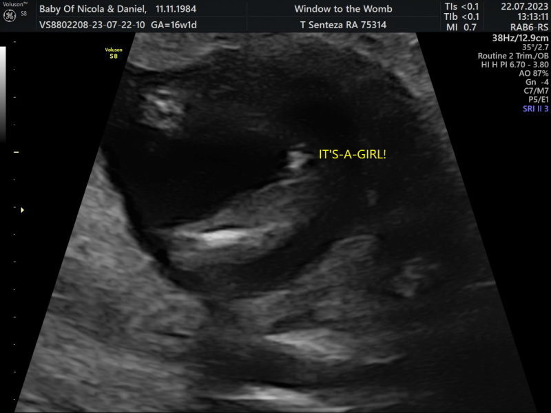 Due January Part 5 🎉