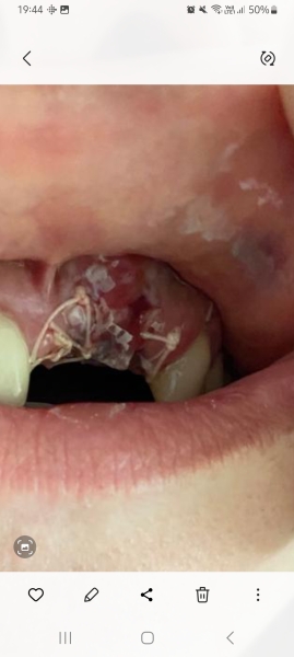 Can I interest anyone in a tooth extraction? (gross, sorry) 