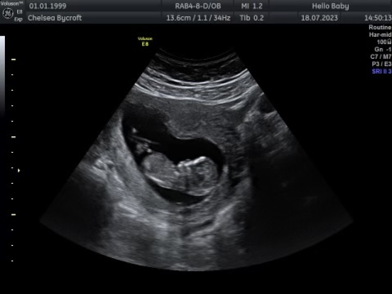 Boy or Girl