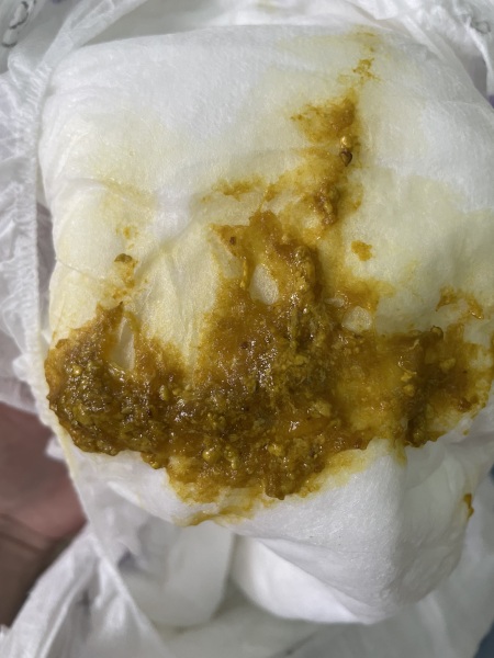 Is this blood in dirty nappy