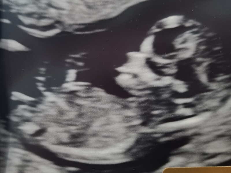 Due January Part 4! 🎉