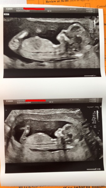 February 2024 babies 🤰 (Thread 2)
