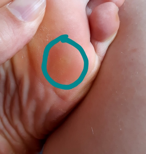 What's this? (Pic of foot) 