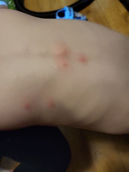 What are these spots?