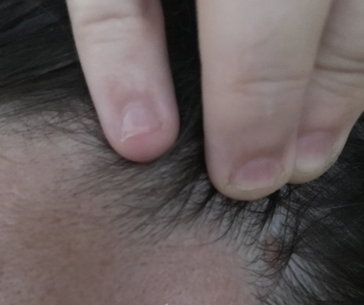 What is this lump?